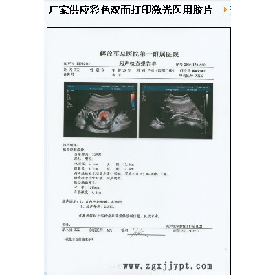 **--A4激光打印胶片 PET透明激光打印胶片图3