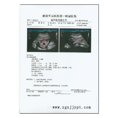 过塑膜,塑封膜,A4喷墨打印胶片,PET打印胶片,投影胶片图2