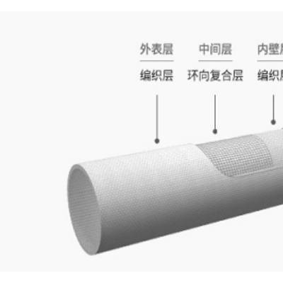 bwfrp电缆保护管安装-晋中bwfrp电缆保护管-金方大图1